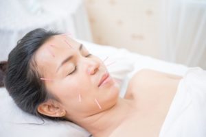 Akupunkturpunkte im Gesicht bei Herpes